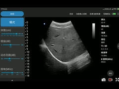 CE Marked 3.6MHz Convex Probe เข้ากันได้กับระบบ Android และ iOS