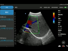 CE ได้รับการอนุมัติ Electronic Convex Array USG Cardiac Probe Ultrasound สำหรับ Android