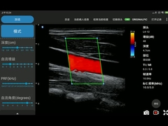 12MHz Wireless Iphone Ultrasound Scanners Electronic Linear Array