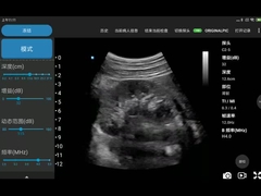 CE Marked 3.6MHz Portable Wifi Ultrasound Scanners JPEG BMP PNG MPEG-4