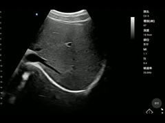 เครื่องสแกนสุขภาพแบบพกพาอุปกรณ์การแพทย์แบบพกพา ISO13485 Convex Probe Handheld Health Scanner