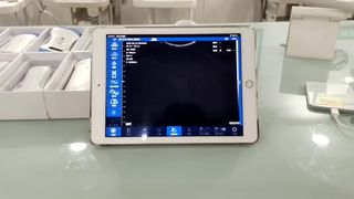 โพรบอัลตราซาวนด์ไร้สายแบบ Dual Head สำหรับการวินิจฉัย OB GYN