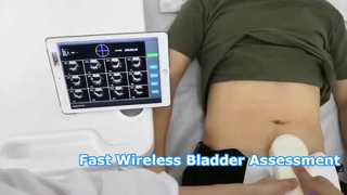 เครื่องสแกนกระเพาะปัสสาวะ 4D ไร้สาย BS1 Portable Point of Care
