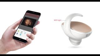 Marvoto Fetus Camera M1- อัลตราซาวนด์มือถือ 3 มิติ