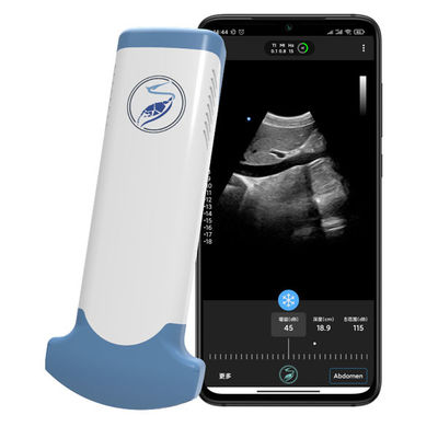 ซื้อ CE Marked 3.6MHz Portable Wifi Ultrasound Scanners JPEG BMP PNG MPEG-4 online manufacture