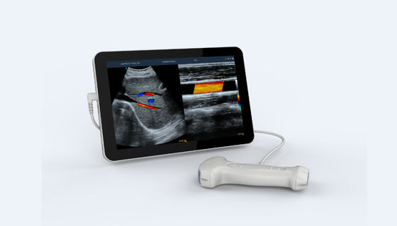 ซื้อ 5V Dual Head Portable Handheld Ultrasound Scanner ความถี่สูง online manufacture