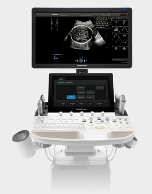 ซื้อ รถเข็นเครื่องอัลตร้าซาวด์ SonoScape ที่ใช้ปัญญาประดิษฐ์ P60 Exp online manufacture