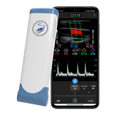 ซื้อ เครื่องสแกนอัลตราซาวด์มือถือไร้สาย 12MHz สำหรับ iPhone และ iPad | โพรบ Doppler สีอาร์เรย์เชิงเส้นอิเล็กทรอนิกส์ online manufacture