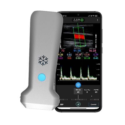 ซื้อ เครื่องสแกนอัลตราซาวนด์ Doppler สีมือถือเชิงเส้นไร้สาย WiFi | การถ่ายภาพแบบเรียลไทม์ 30 FPS | โพรบอัลตราซาวนด์ทางการแพทย์แบบพกพา online manufacture