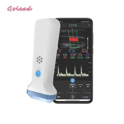 ซื้อ 12MHz 3000mAh Wireless Probe Type Ultrasound Scanner สำหรับ Iphone online manufacture