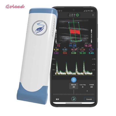 ซื้อ เครื่องสแกนอัลตราซาวด์แบบพกพาไร้สายแบบ Linear Array Wifi 12MHz online manufacture