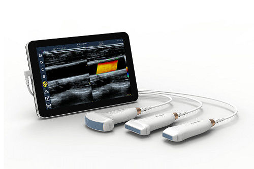 ซื้อ USB Type-C เครื่องอัลตราซาวด์มือถือเชิงเส้น 10MHz แบบพกพา Android Ultrasound Probe สำหรับหลอดเลือดและ POCUS online manufacture
