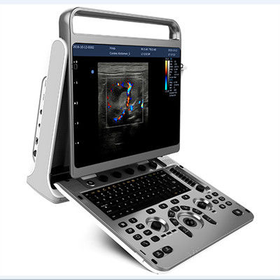 ซื้อ เครื่องอัลตร้าซาวด์พกพาออกแบบตามหลักสรีรศาสตร์ Chison EBit 30 online manufacture