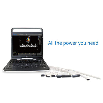 ซื้อ 128 Element Wifi Ultrasound Chison EBit 60 สำหรับหลอดเลือดหัวใจ online manufacture
