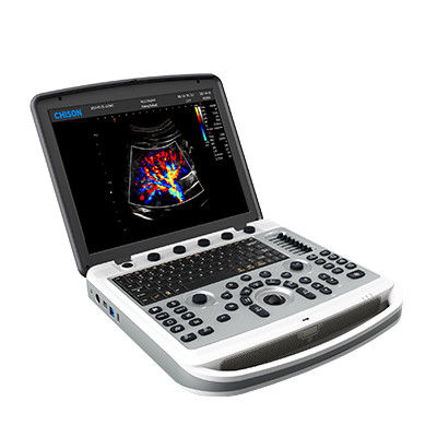 ซื้อ เครื่องอัลตร้าซาวด์แบบพกพา Chison SonoBook 6 แบบหมุนได้ 120° online manufacture