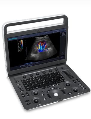 ซื้อ เครื่องอัลตร้าซาวด์ LED Sonoscape E1 Exp ขนาด 15.6 นิ้ว BW Ultrasound online manufacture