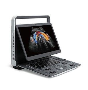 ซื้อ เครื่องอัลตร้าซาวด์แบบพกพา SonoScape E2 PRO การถ่ายภาพพาโนรามา online manufacture