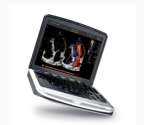 ซื้อ เครื่องอัลตร้าซาวด์แล็ปท็อปที่ได้รับการอนุมัติจาก FDA Chison SonoBook 8 สำหรับการตรวจหัวใจด้วยคลื่นไฟฟ้าหัวใจ online manufacture