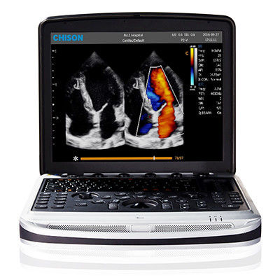 ซื้อ เครื่องอัลตร้าซาวด์แล็ปท็อป 4D Chison SonoBook 9 พกพาสะดวก online manufacture