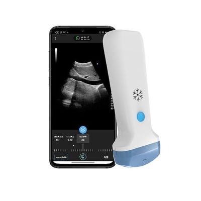 ซื้อ HDMI Output Wireless Convex Handheld Ultrasound Scanner 3.6MHz โปรแกรมด็อปปเลอร์สีพกพา POCUS อัลตรัสโว online manufacture
