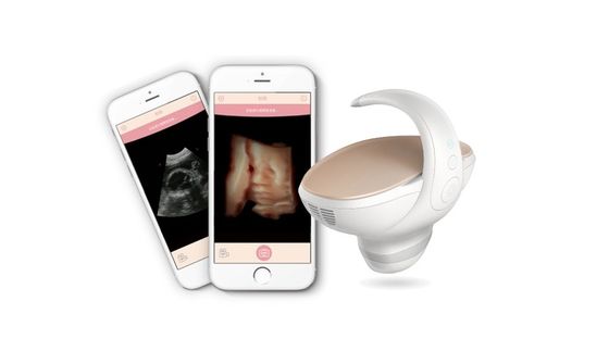ซื้อ เครื่องสแกนอัลตร้าซาวด์ลูกลูกลูกที่ถือมือ 3D/4D ที่ได้รับการอนุมัติจาก CE
โปรแกรมถ่ายภาพการตั้งครรภ์แบบพกพา พร้อมเครื่องตรวจสอบขอบมุมกว้าง 60° online manufacture