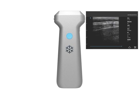 ซื้อ เครื่องอัลตร้าซาวด์พกพาไร้สาย Linear Probe 32 Channel online manufacture