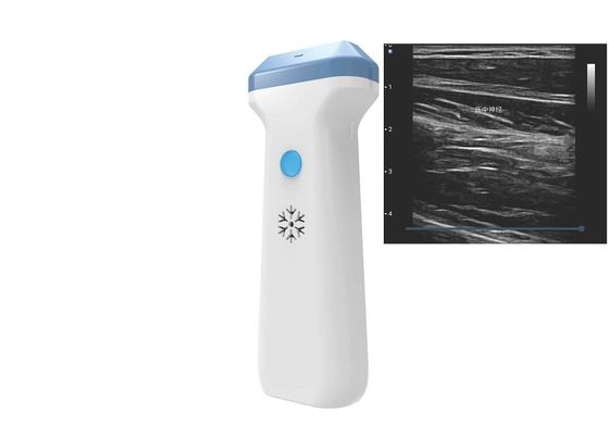 ซื้อ DICOM BMP PNG JPEG 128 องค์ประกอบ Wifi Ultrasound Probe 80 To180dB online manufacture