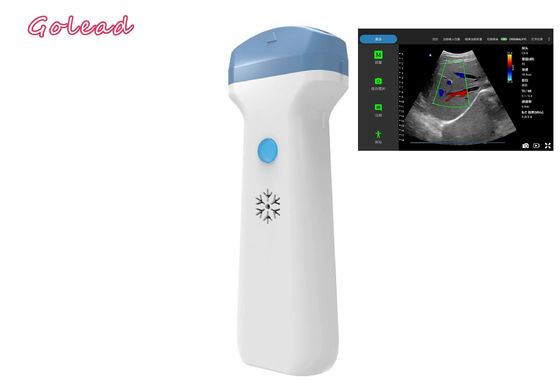 ซื้อ Anesthesia Ipad Wireless Ultrasound Probe สำหรับการสอบ POCUS การดูแลเบื้องต้น online manufacture