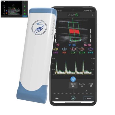 ซื้อ 256 Scan Lines Ipad Ultrasound Transducer Wireless Ultrasound Probe สำหรับ PICC online manufacture