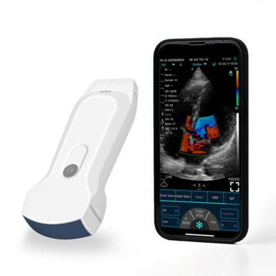 ซื้อ เครื่องสแกนอัลตราซาวนด์มือถือ POCUS แบบพกพา IPad สำหรับการวินิจฉัยทางคลินิก online manufacture