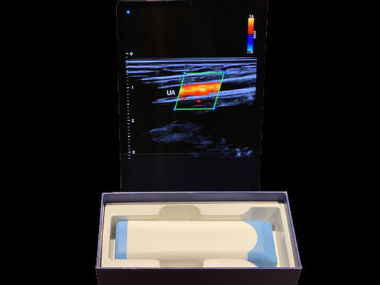 ซื้อ สแกนอัลตราซาวด์มือถือระดับสูง 0.2 กิโลกรัม พร้อมแบตเตอรี่ขนาด 3000mAh สําหรับการแพทย์ online manufacture