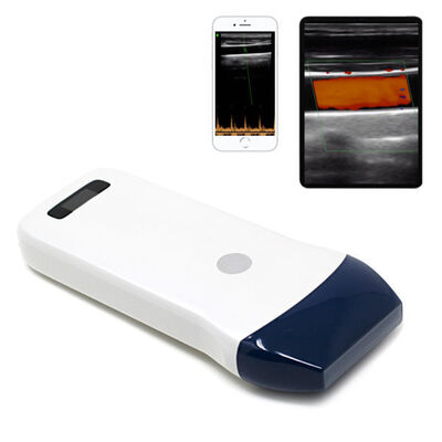 ซื้อ เครื่องสแกนอัลตราซาวนด์ Linear Probe ไร้สายสำหรับการเข้าถึงหลอดเลือด การปิดกั้นเส้นประสาท และการถ่ายภาพกล้ามเนื้อและกระดูก online manufacture