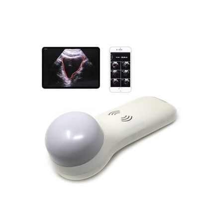 ซื้อ เครื่องสแกนกระเพาะปัสสาวะแบบพกพา 4D ไร้สายสำหรับการวัดปริมาตรปัสสาวะ ณ จุดดูแล online manufacture