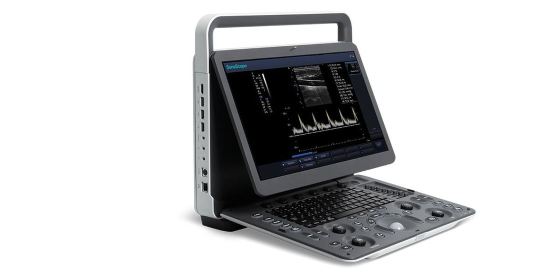 เครื่องอัลตร้าซาวด์ Doppler สีแบบพกพา LED SonoScape ขนาด 15.6 นิ้ว BW อัลตร้าซาวด์