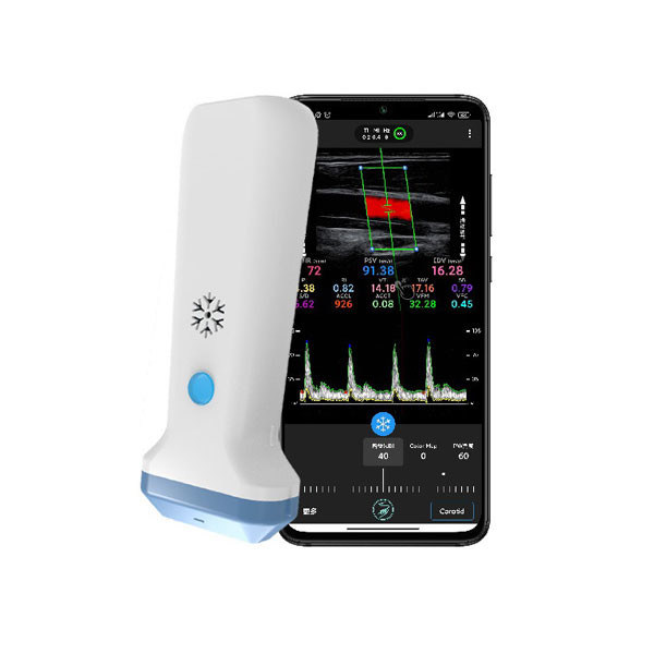 เครื่องสแกนอัลตราซาวนด์มือถือเชิงเส้นไร้สาย | โพรบอัลตราซาวนด์ Doppler สีแบบพกพา 4 / 8.3 / 12MHz