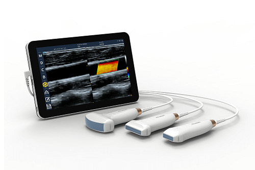 USB Type-C เครื่องอัลตราซาวด์มือถือเชิงเส้น 10MHz แบบพกพา Android Ultrasound Probe สำหรับหลอดเลือดและ POCUS