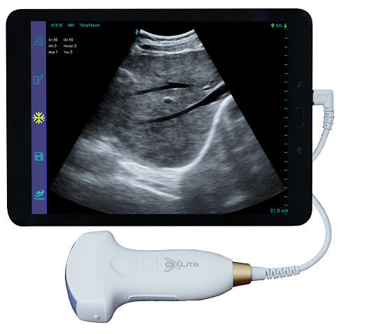 เครื่องสแกนอัลตราซาวด์แบบใช้มือถือสี Doppler อาร์เรย์นูนแบบอิเล็กทรอนิกส์ 3.5MHz