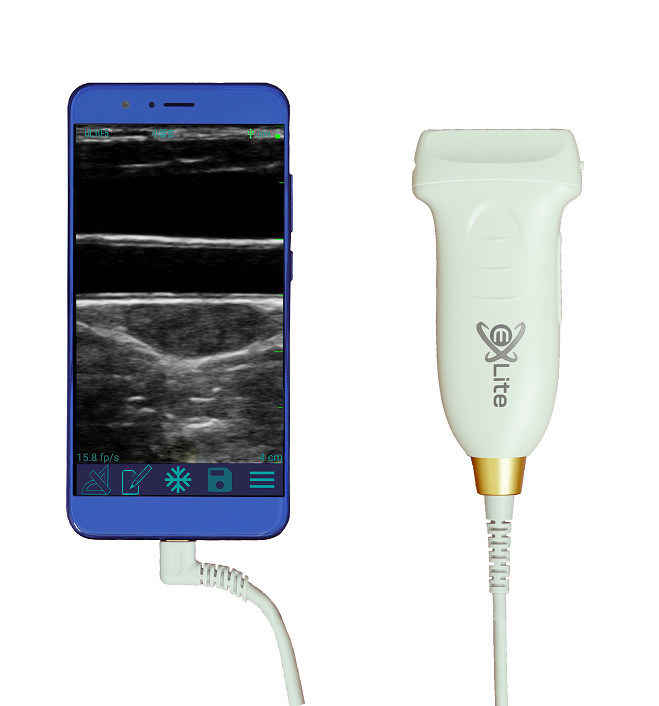 USB Type-C เครื่องอัลตราซาวด์มือถือเชิงเส้น 10MHz แบบพกพา Android Ultrasound Probe สำหรับหลอดเลือดและ POCUS