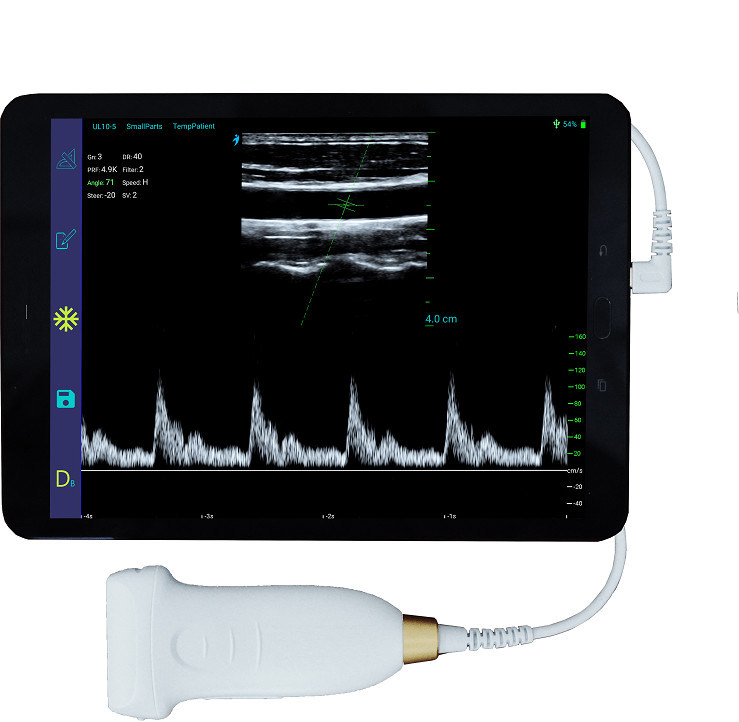 USB Type-C เครื่องอัลตราซาวด์มือถือเชิงเส้น 10MHz แบบพกพา Android Ultrasound Probe สำหรับหลอดเลือดและ POCUS