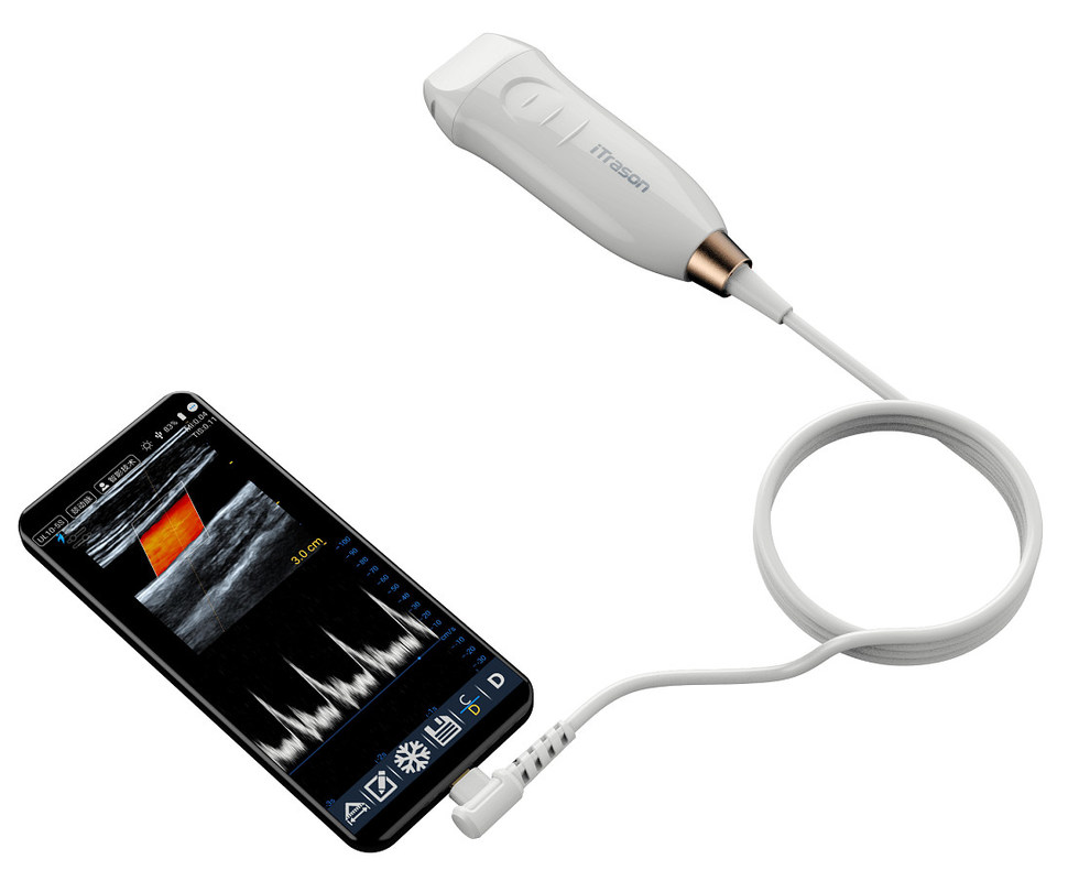เครื่องสแกนอัลตราซาวนด์มือถือพร้อมโพรบเชิงเส้นความถี่สูง 12MHZ เพื่อการเข้าถึงหลอดเลือดที่แม่นยำและขั้นตอนการแทรก PICC