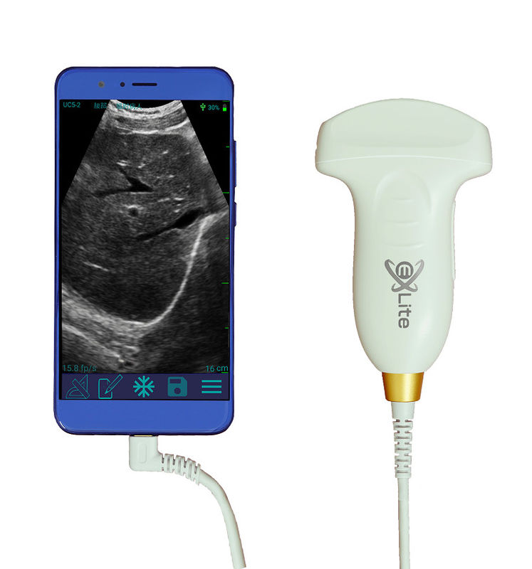 เครื่องสแกนอัลตราซาวด์แบบใช้มือถือสี Doppler อาร์เรย์นูนแบบอิเล็กทรอนิกส์ 3.5MHz