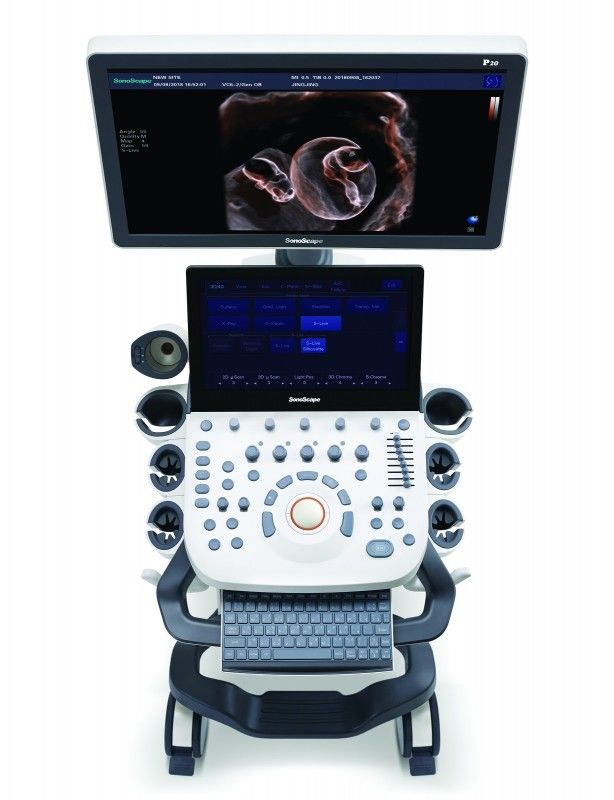 21.5'' LED Sonoscape P10 Trolley Color Doppler เครื่องอัลตร้าซาวด์