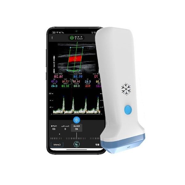 เครื่องตรวจอัลตร้าซาวด์ Doppler สีแบบพกพาขนาด 12.6 ซม. สำหรับผู้เชี่ยวชาญด้านการดูแลสุขภาพ