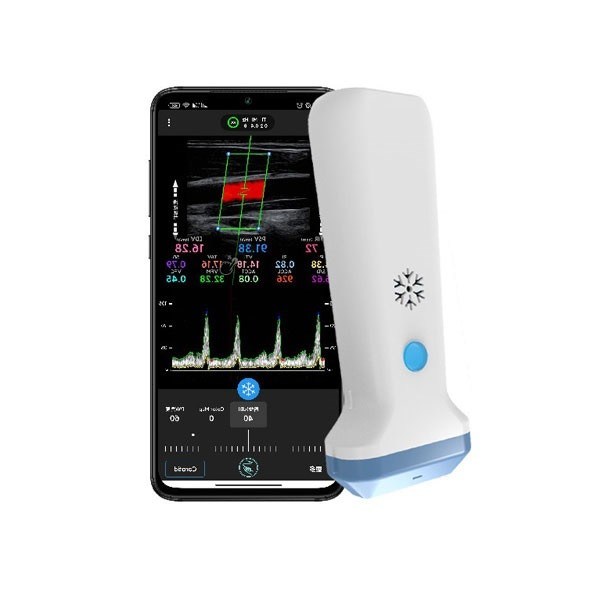 แบบพกพาสี Doppler ไร้สาย Linear Ultrasound Scanner 12.6 ซม.มือถือ POCUS อัลตราซาวด์สำหรับผู้เชี่ยวชาญด้านการดูแลสุขภาพ