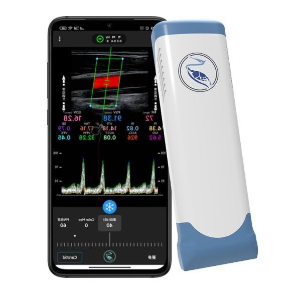 Echo Color Doppler Wireless Handheld Ultrasound Scanner 100 เฟรม