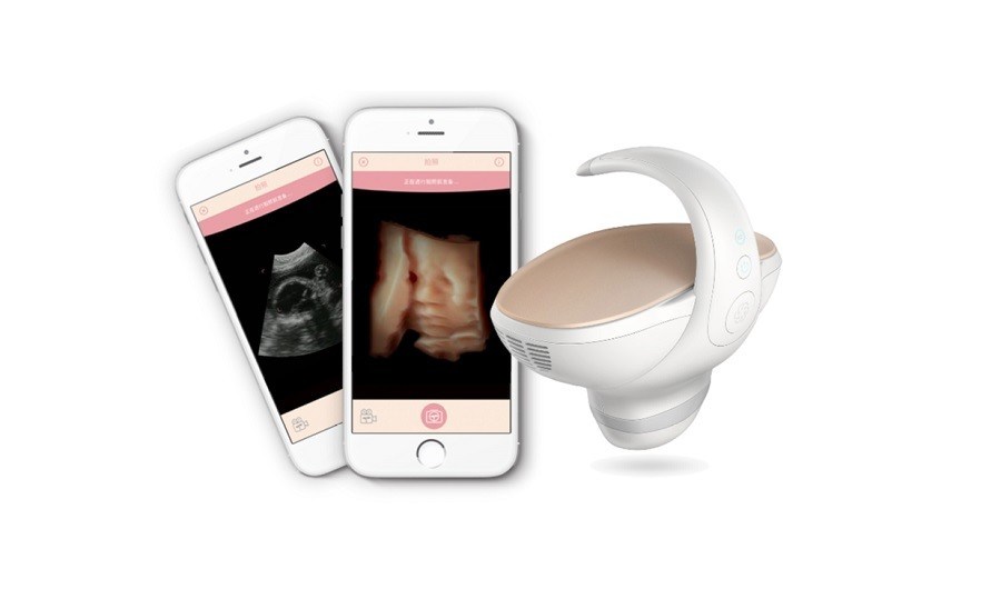 เครื่องสแกนอัลตร้าซาวด์ลูกลูกลูกที่ถือมือ 3D/4D ที่ได้รับการอนุมัติจาก CE
โปรแกรมถ่ายภาพการตั้งครรภ์แบบพกพา พร้อมเครื่องตรวจสอบขอบมุมกว้าง 60°