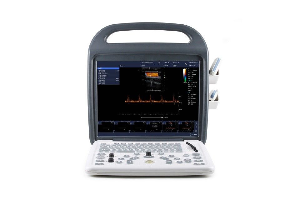 15'' High Definition LCD Monitor Color Doppler Ultrasound Machine Portable 7.5kg
