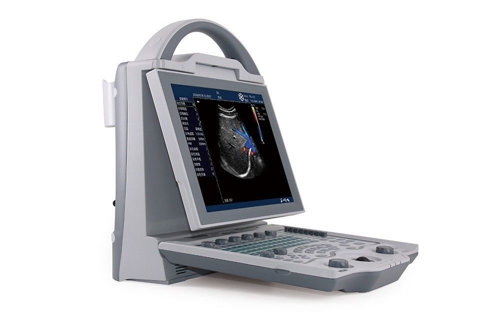 16GB Entry Level 2D Laptop Color Doppler Ultrasound System สำหรับการตั้งครรภ์