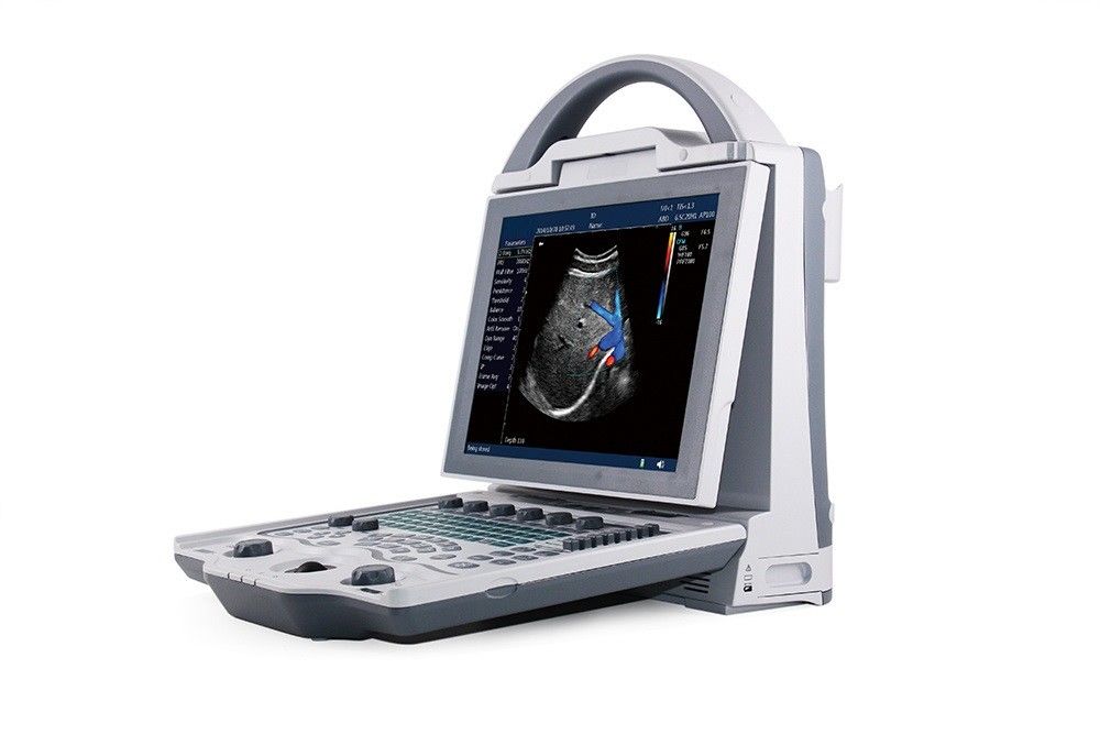 16GB Entry Level 2D Laptop Color Doppler Ultrasound System สำหรับการตั้งครรภ์