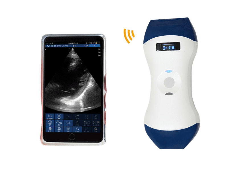 FDA CE ISO13485 โพรบอัลตราซาวนด์มือถือไร้สายขนาดปาล์มพร้อม Phased Array และ Linear Dual Head สำหรับ POCUS